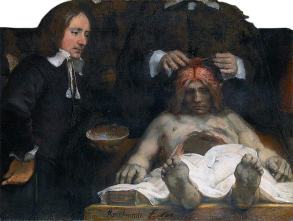 La Leçon d’anatomie du docteur Deyman – Rembrandt van Rijn Rembrandt van Rijn
